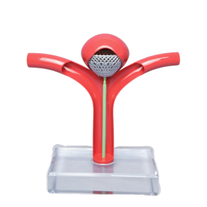 brain aneurysm model with flow diverter