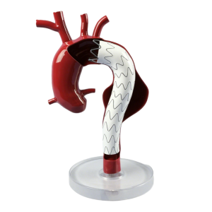 thoracic aortic aneurysm stent graft model