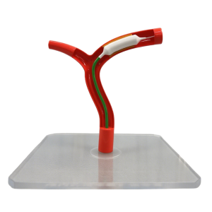 carotid artery model with balloon dilation catheter